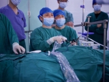 【辐射西南】王佳峰率队到镇雄县中医医院指导开展“腋窝腔镜甲状腺癌根治术”