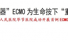 “救命神器”ECMO为生命按下“重启”键——英国正版365官网成功开展首例ECMO技术
